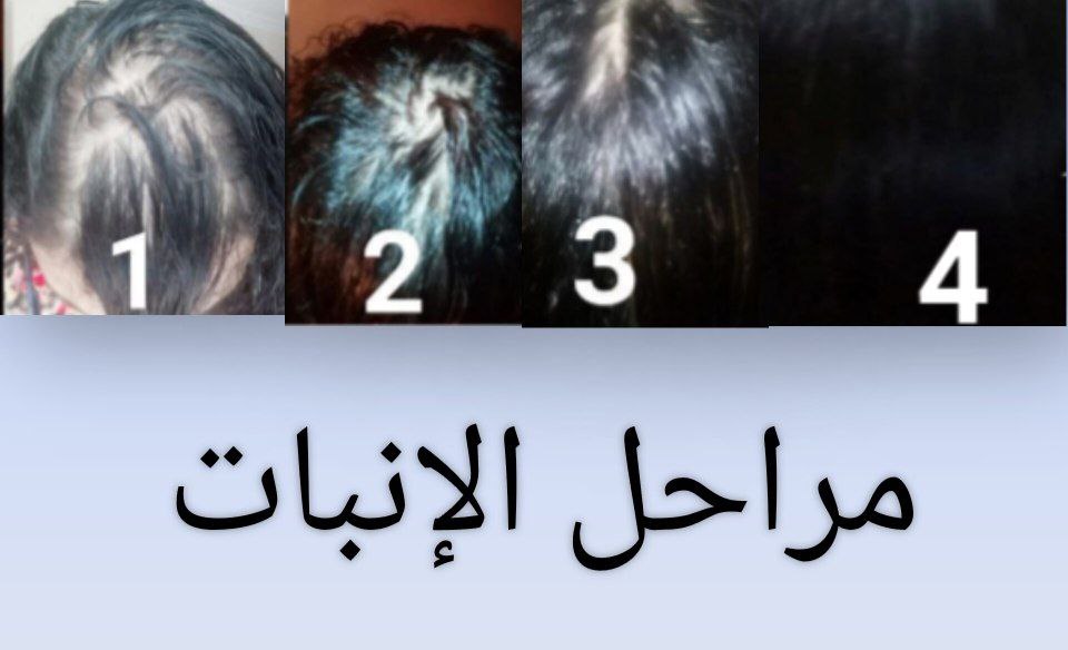 مراحل الانبات