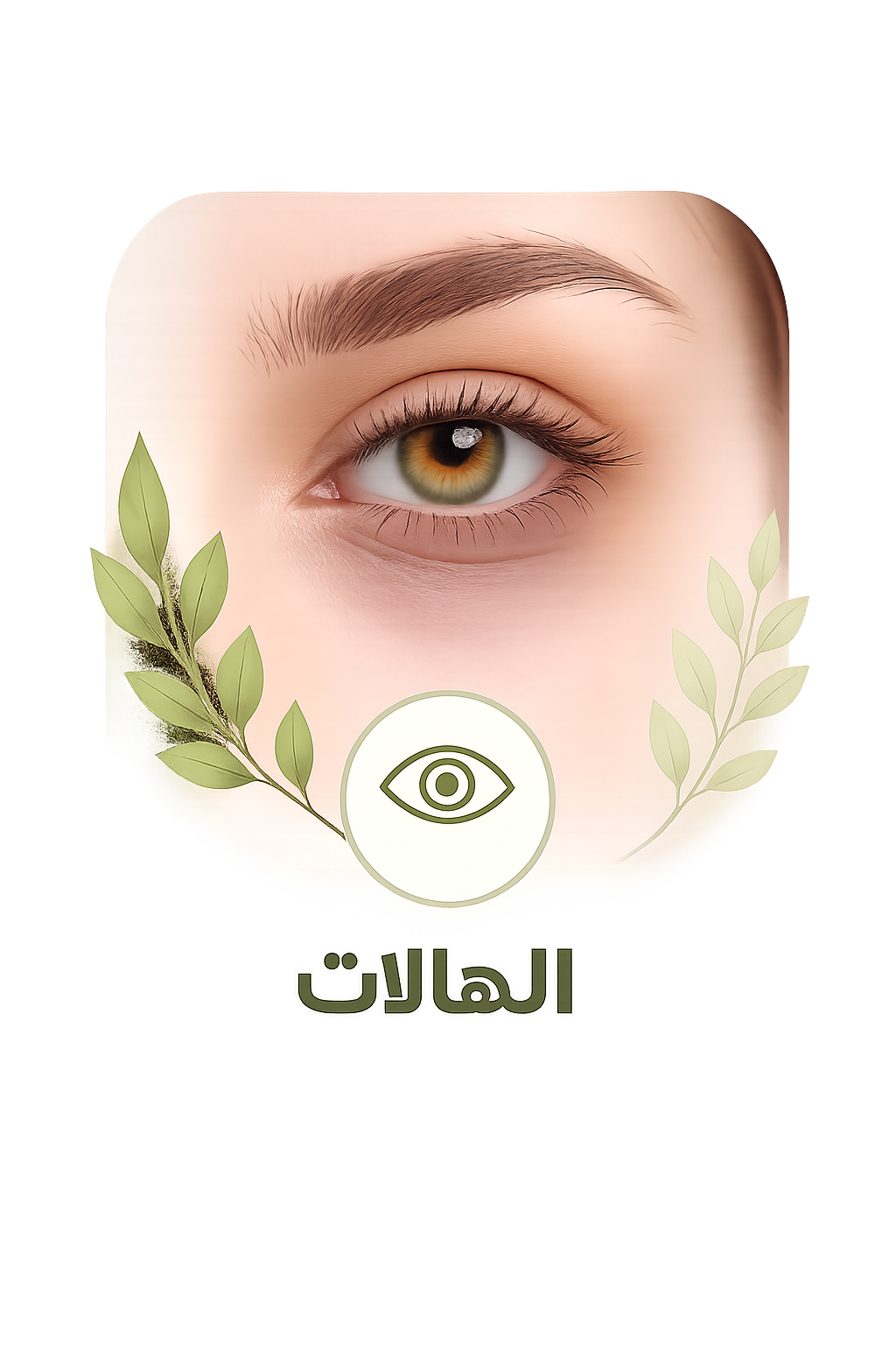 الهالات